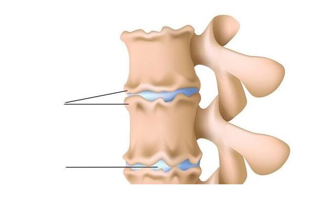 Spine injury