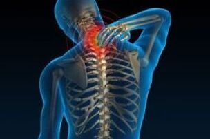 Cervical osteochondosis causes pain in the neck