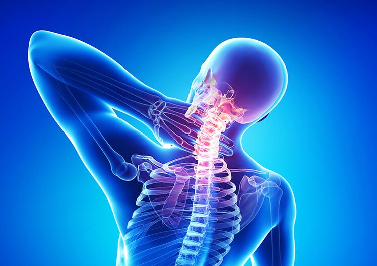 Osteochondrosis of the spine is a disease that affects the articular cartilage and vertebrae.